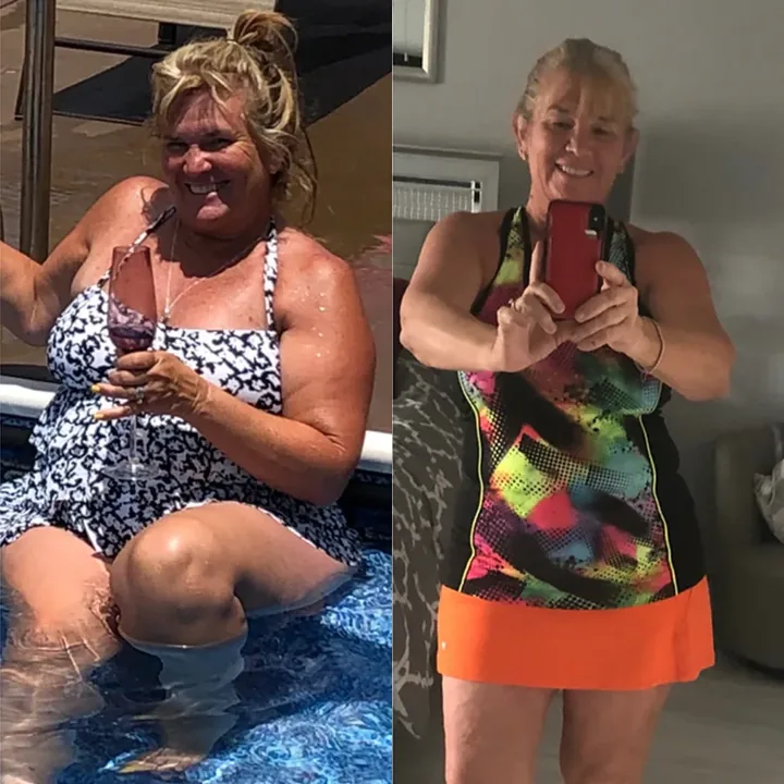 The Woman Behind the “Baking Soda Shot” Says the Internet Left Out Two Steps 5 Verified Transformation Results